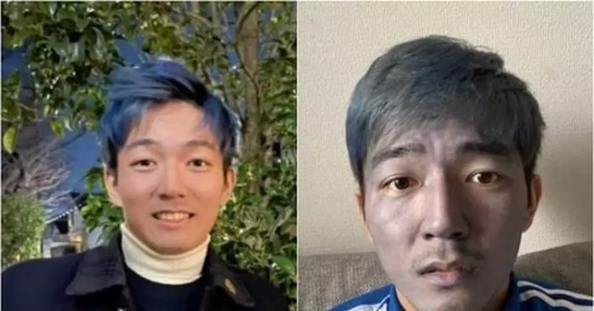 誤把染髮劑當洗面乳 帥氣小哥洗成「茄子臉」