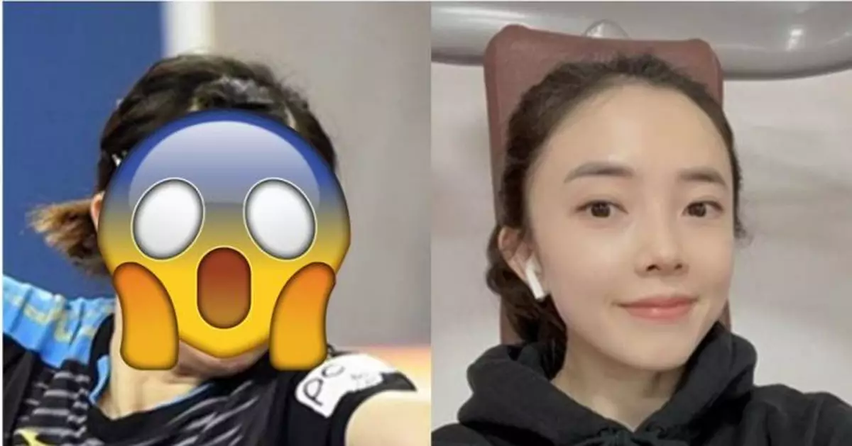 東奧女乒韓選手田志希被爆舊照大方承認曾整容 19歲前是中國籍
