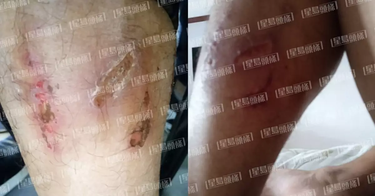 港男赴泰國會面「情人」被賣豬仔到緬甸 慘遭禁錮虐打一個月
