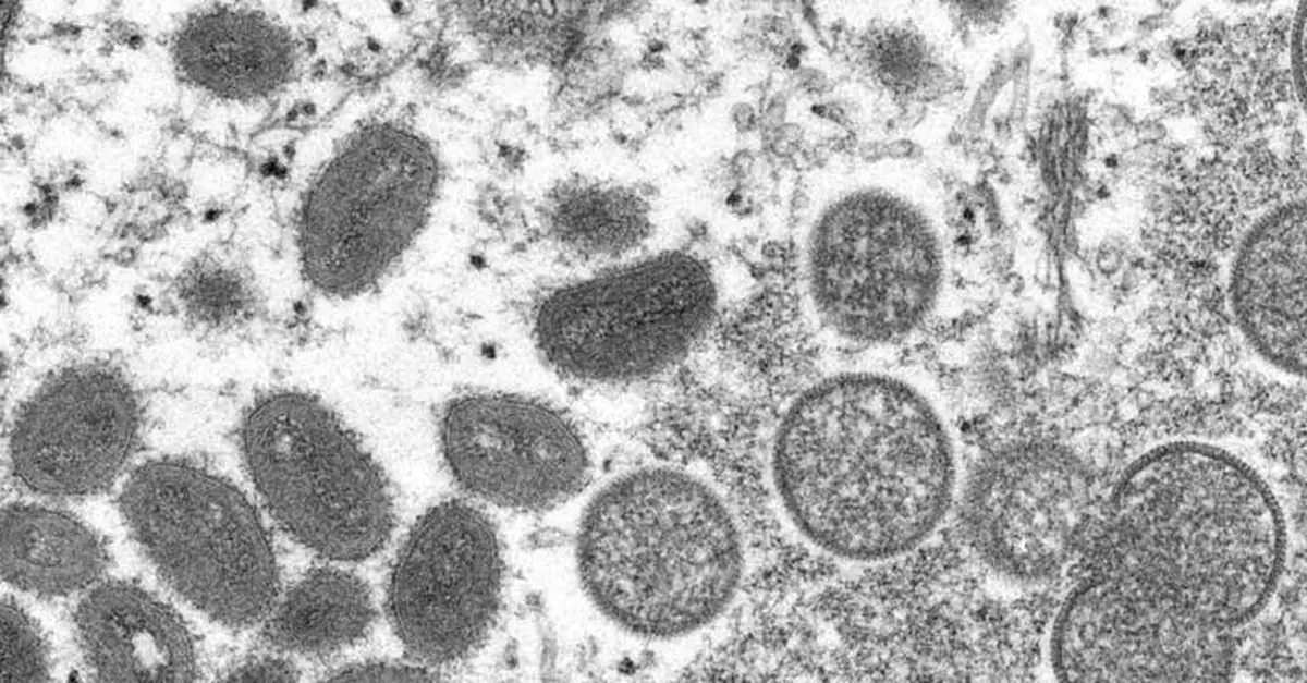 國家衛健委：9月20日起將猴痘納入乙類傳染病管理
