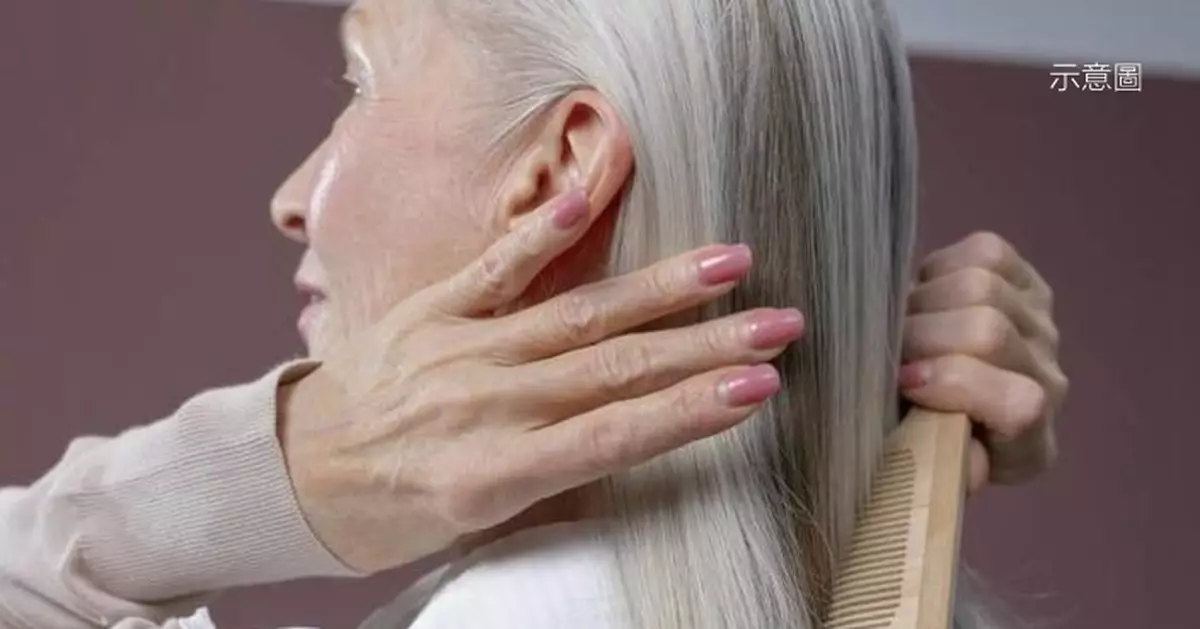 長白頭髮不只是「衰老」或是身體釋警號：壓力太大