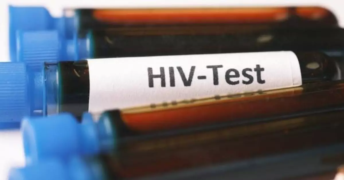 荷蘭研究團隊成功將HIV從細胞上切除 或有望治愈愛滋