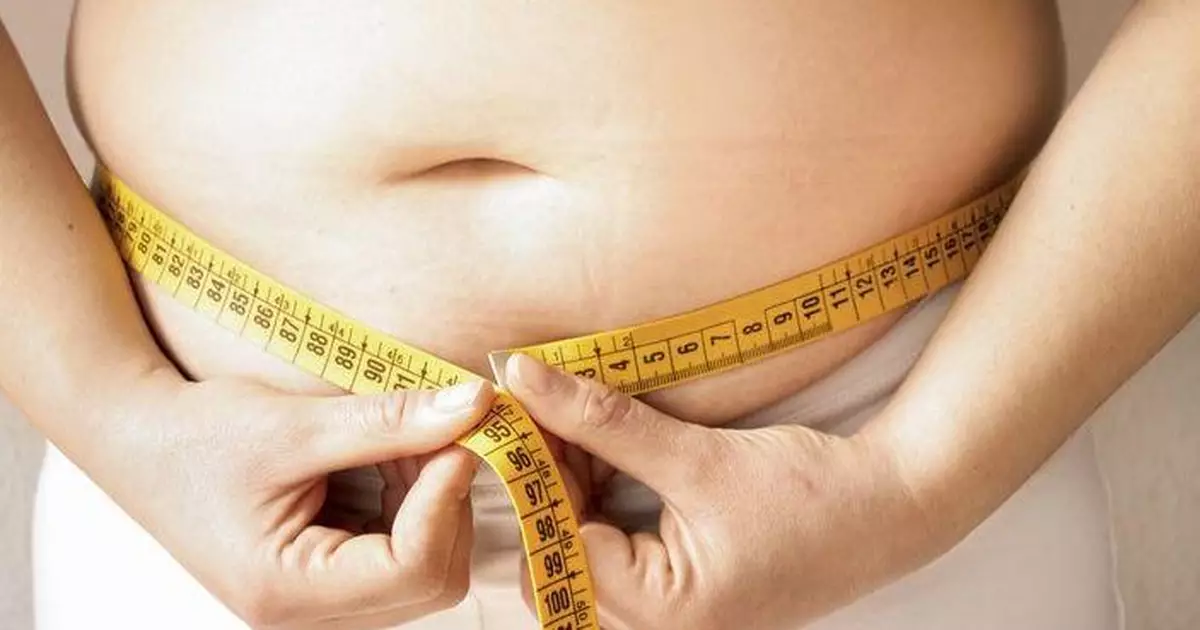 有調查發現港人對肥胖症認知不足　三分一體重超標受訪者自認微胖