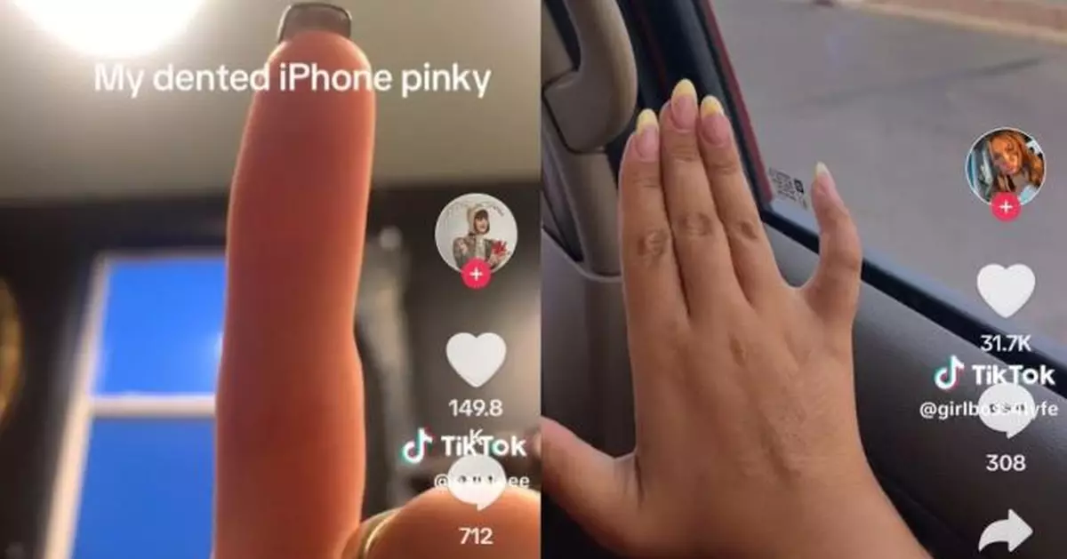 玩手機上癮小指被壓彎？TikTok平台現Phone pinky風潮 專家咁解釋