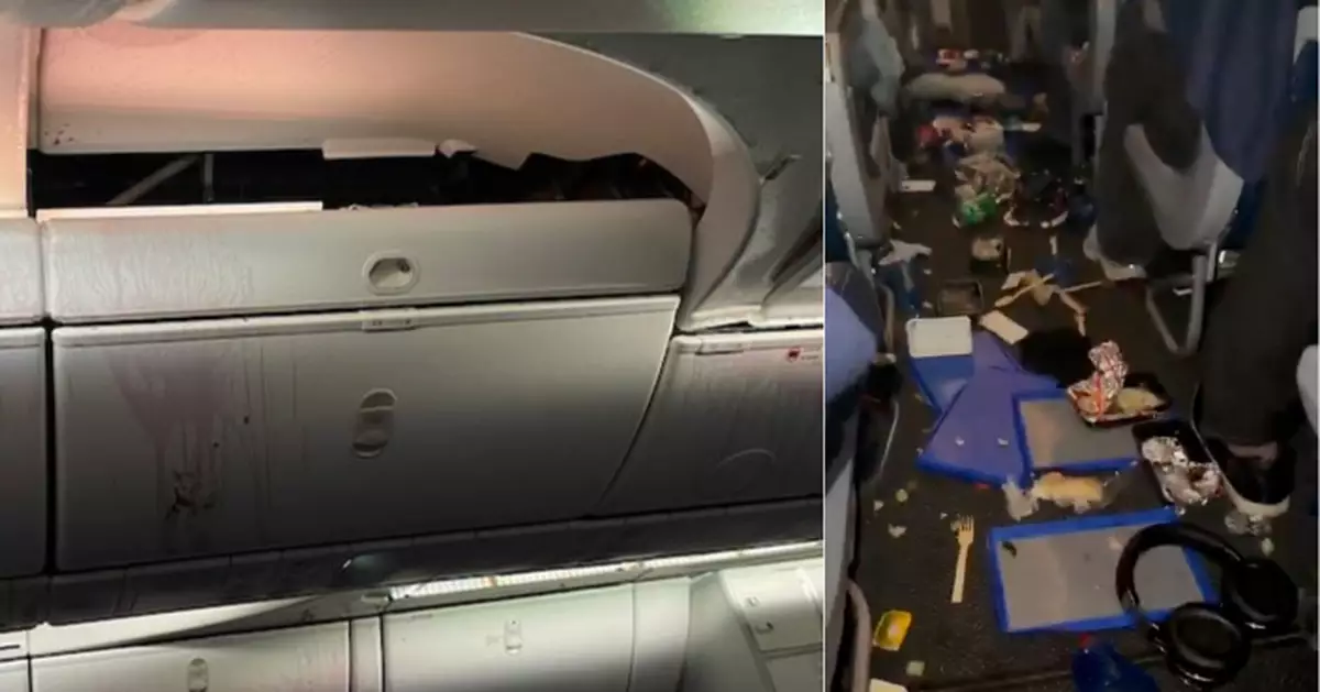 聯合航空787客機 尼日利亞飛美國途中急速下降折返多人傷