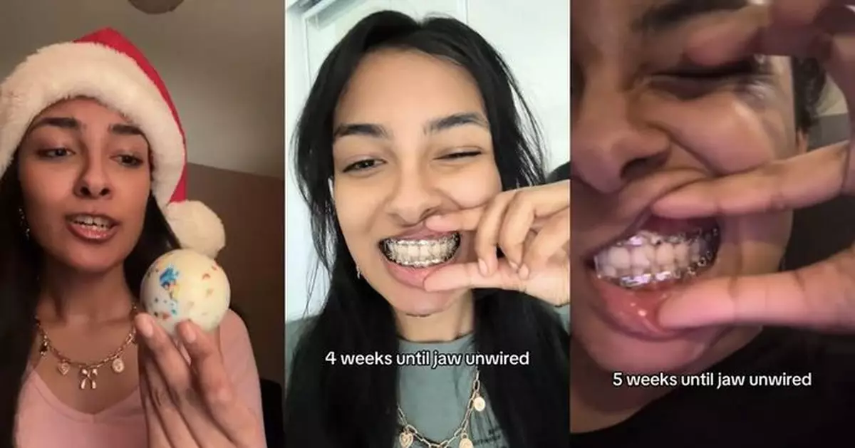 加國女大生挑戰吃「下顎粉碎者」硬糖致下巴骨折