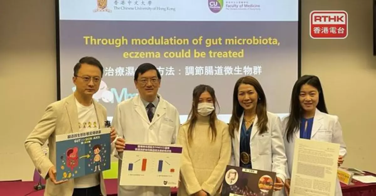 中大：新冠疫情期間出世嬰兒過敏症發病率較疫情前出生多約四成半
