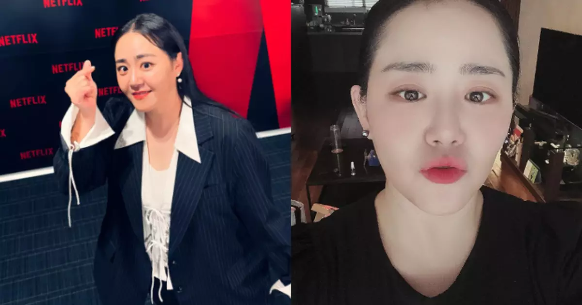 文瑾瑩罹罕見病癒後復出近況曝光 自拍晒V面粉絲讚瘦身成果