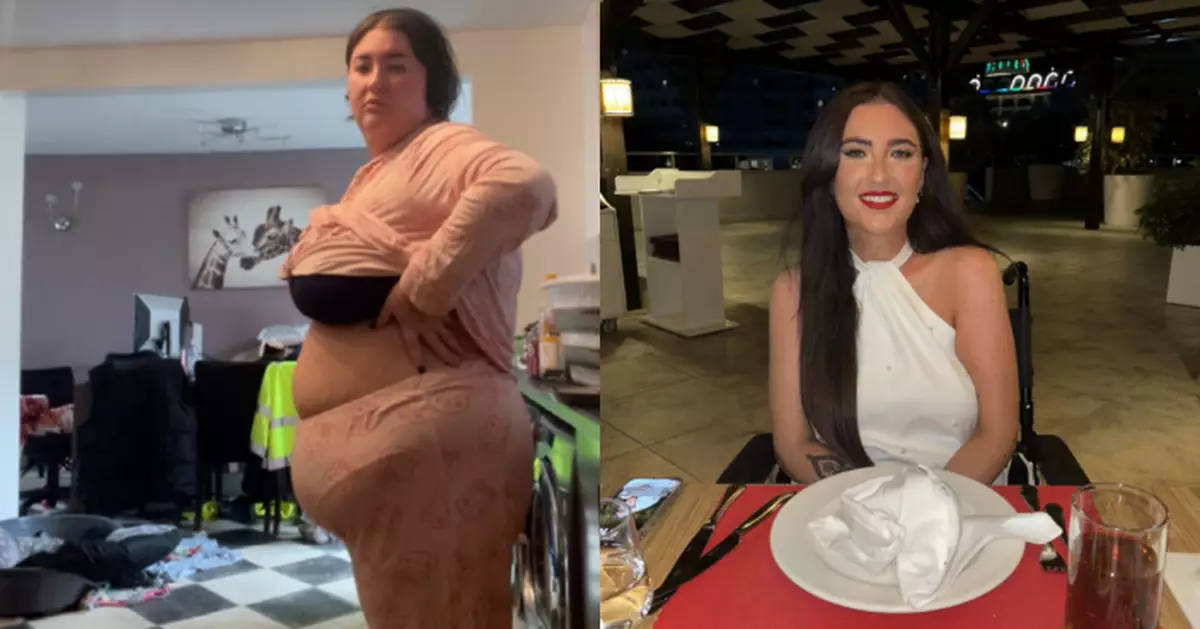 英女斥11萬切胃狂減69KG 卻因無法吸收營養患罕見腦病癱瘓勁後悔