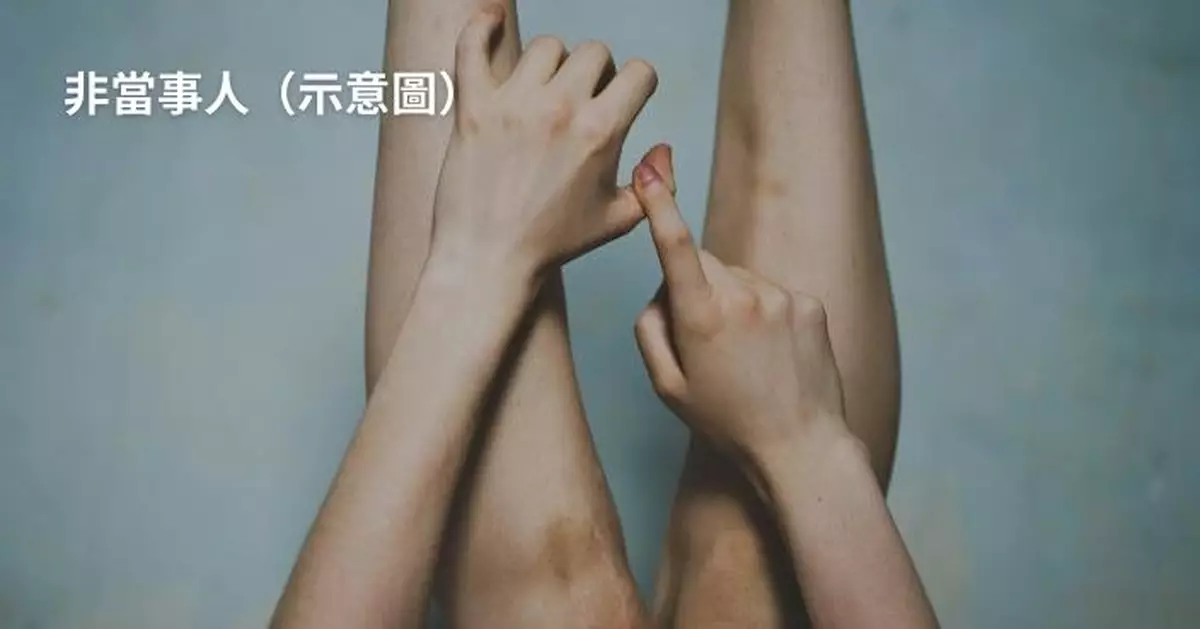 貪平飛土耳其瘦腿 英女手術後大腿現12CM傷口散發惡臭 險因敗血症喪命
