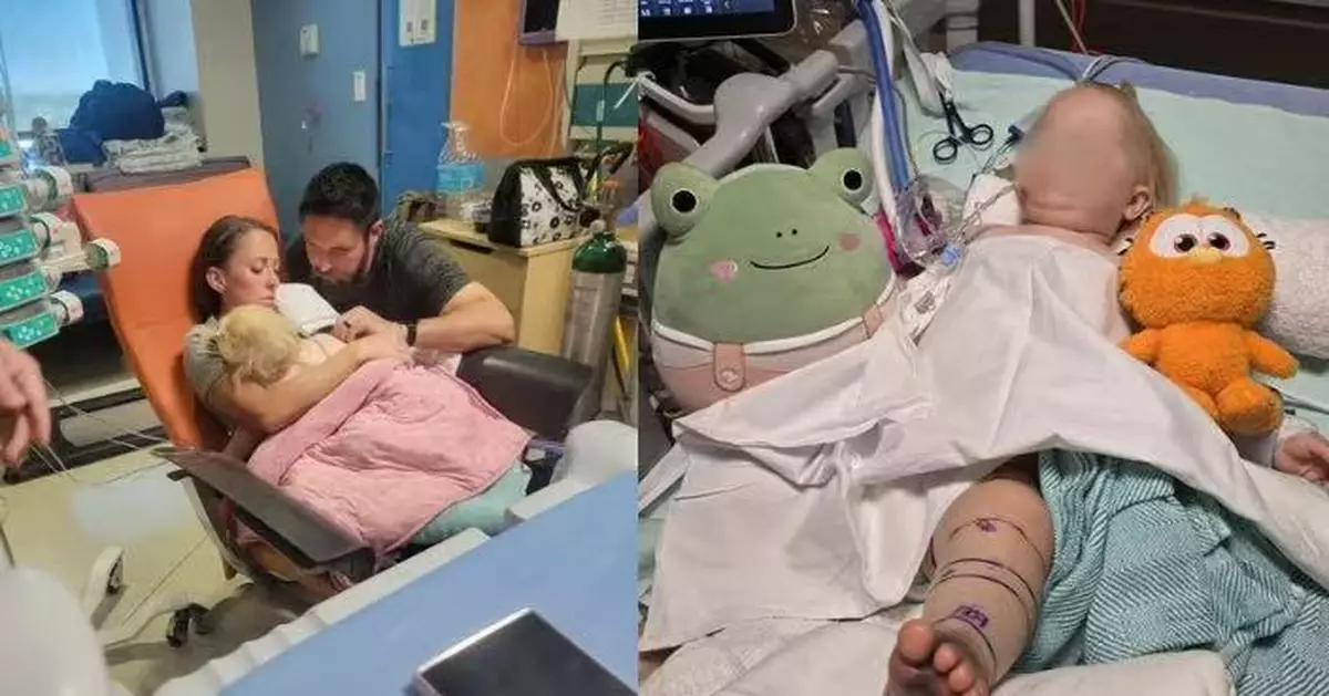 美國15個月大女嬰遭響尾蛇連咬2次 腳背發黑輸30瓶血清仍未脫險