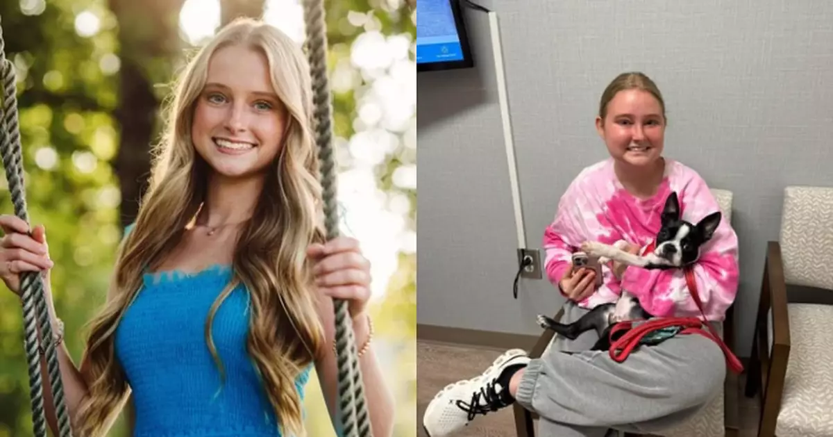 患腦癌臉腫至2倍大 美19歲女分享勵志抗癌經歷1年後終不敵病魔離世