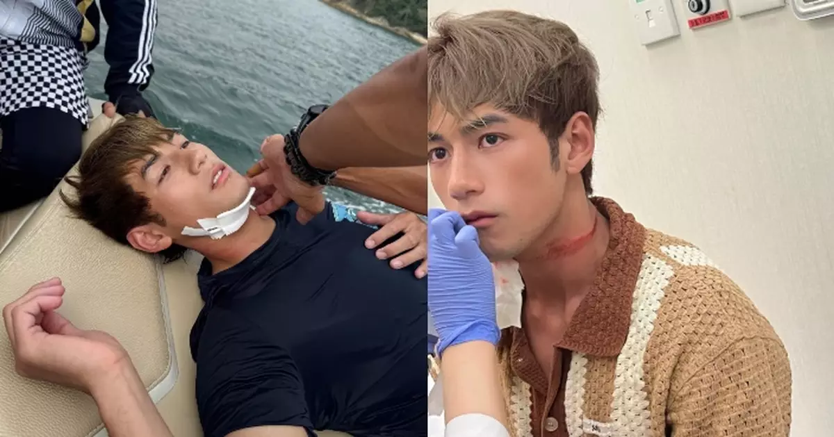 新生代男神魏浚笙拍電影不慎受傷 Jeffrey發文報平安：受傷個刻個腦一片空白