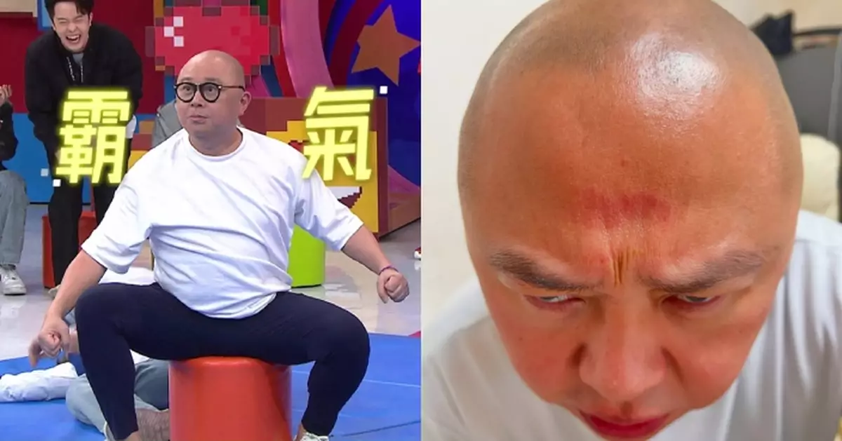 領「女神配對計劃」上《大師兄感謝祭》 林盛斌玩太投入搞到周身傷