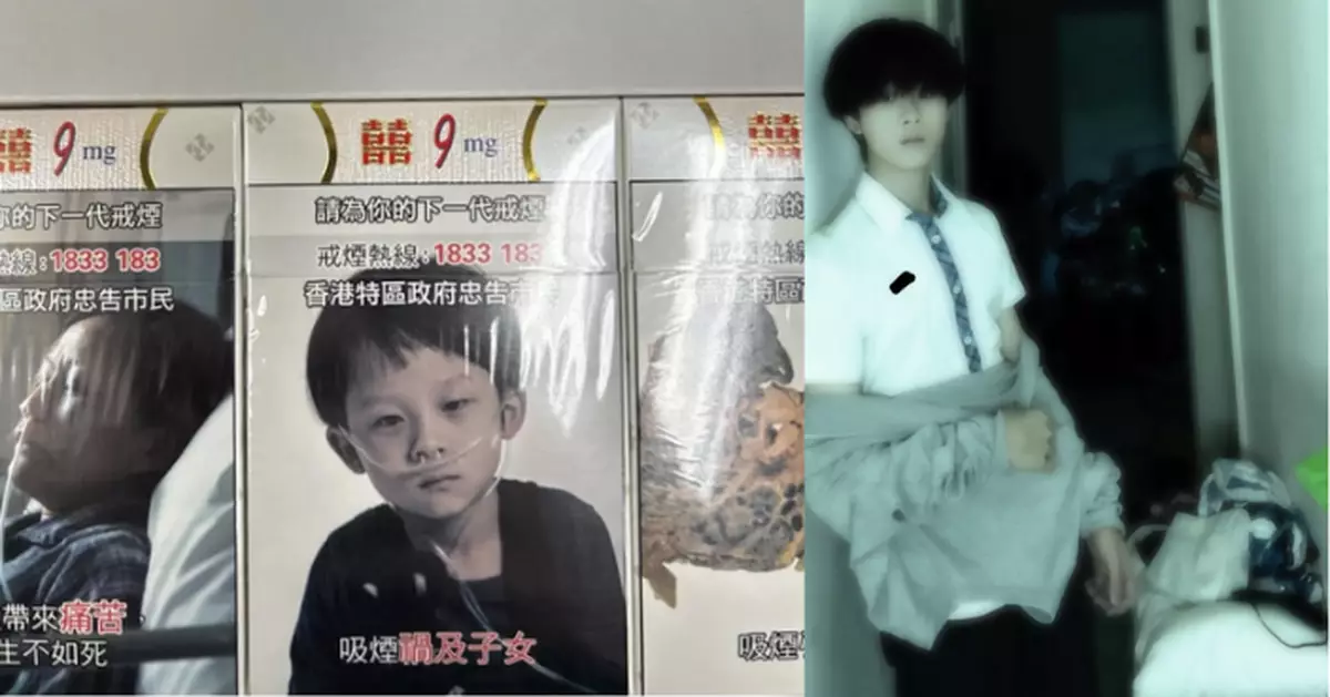 煙盒廣告童星12年後現身　網民驚呼：細路仔大個仔啦！​