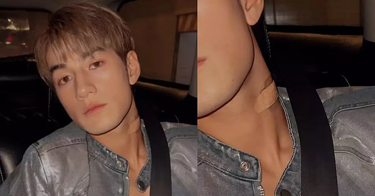 魏浚笙帶傷復工 頸部貼膠布預告下周推出新歌