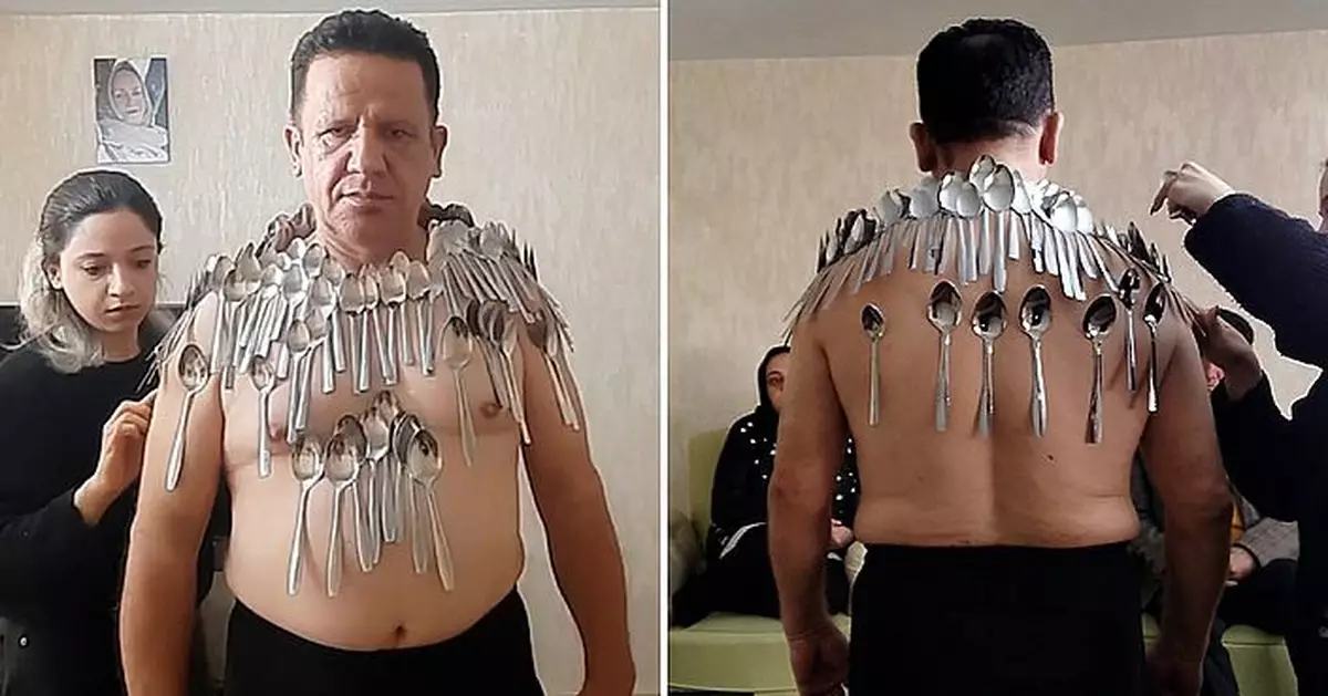 伊朗男天賦特殊技能 身體黏附96支湯匙第三度創世界紀錄