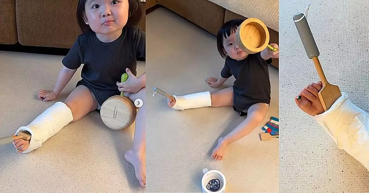 李璨琛2歲細女Sucy骨裂打石膏 用鑊鏟剷石膏畫面爆笑又惹人心疼