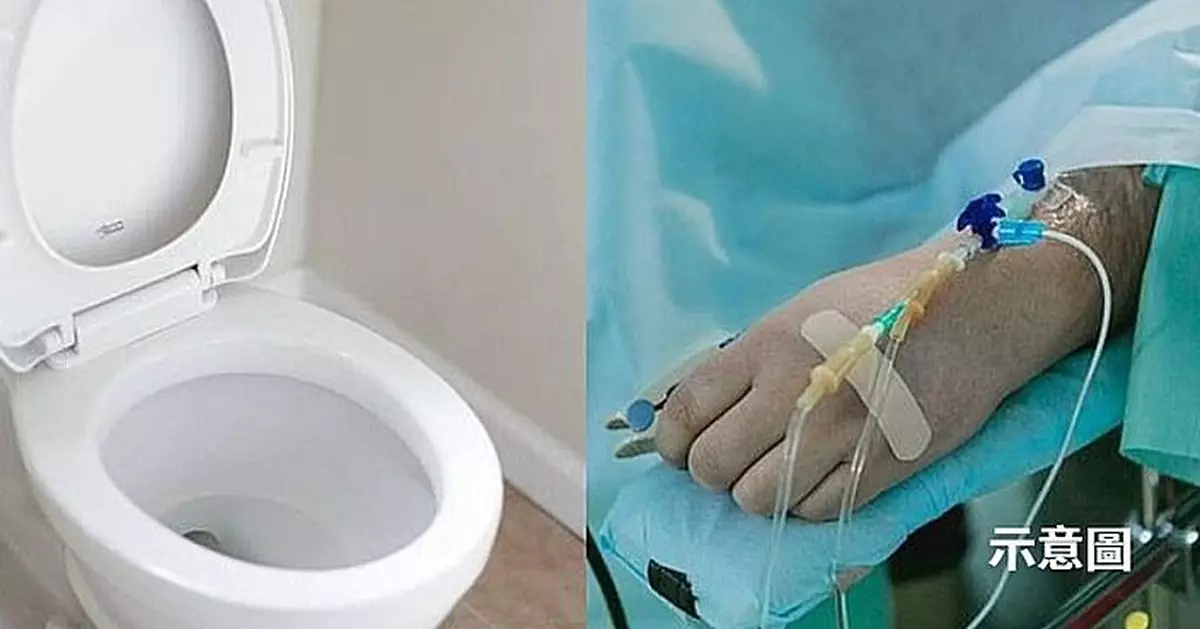 一沖水就炸！馬桶意外爆炸起火 印男慘遭燒傷面積多達35%