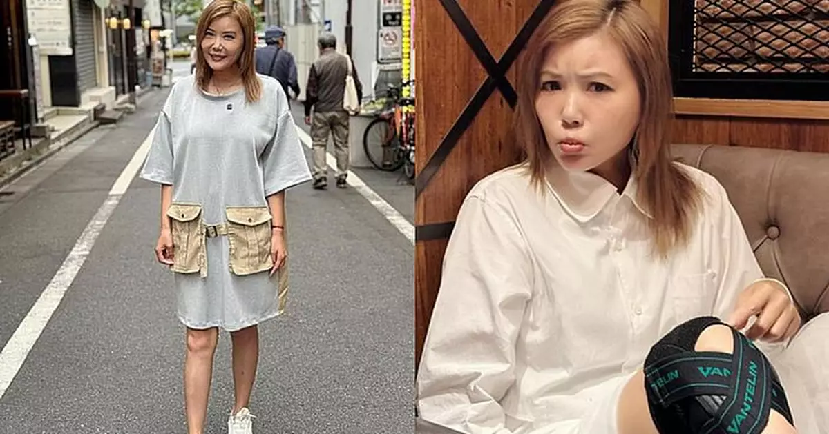 杜如風因工受傷舊患復發 貼身護膝化身「鐵拐李」堅持工作