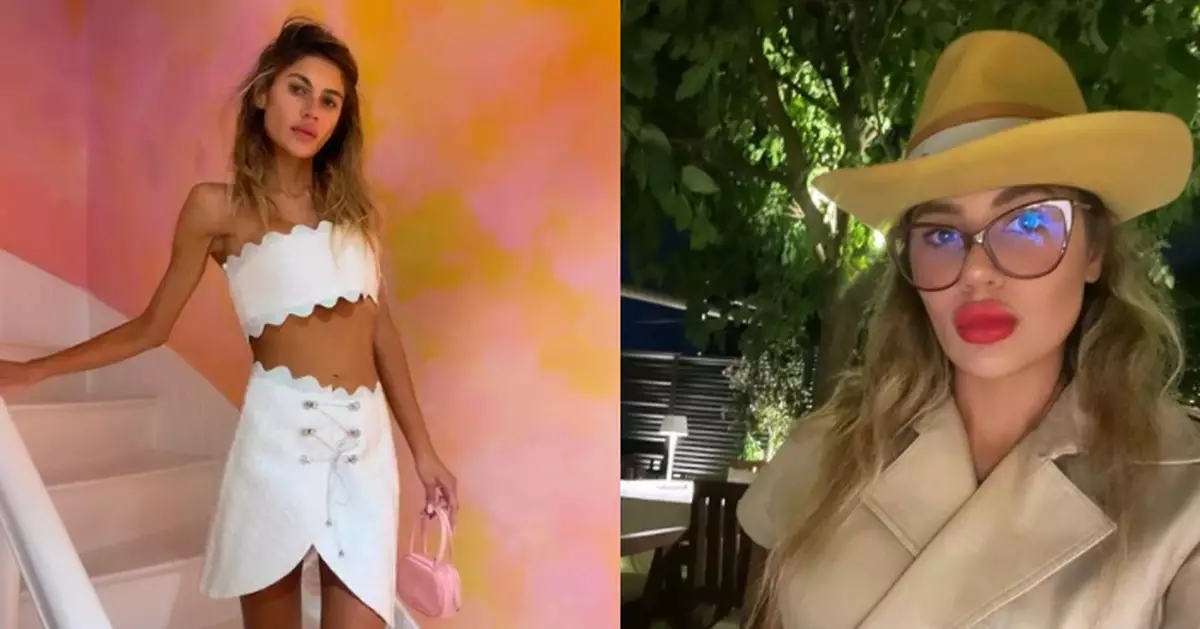 患「神經性厭食症」暴瘦剩22KG 土耳其女星抗病2年不敵病魔逝世