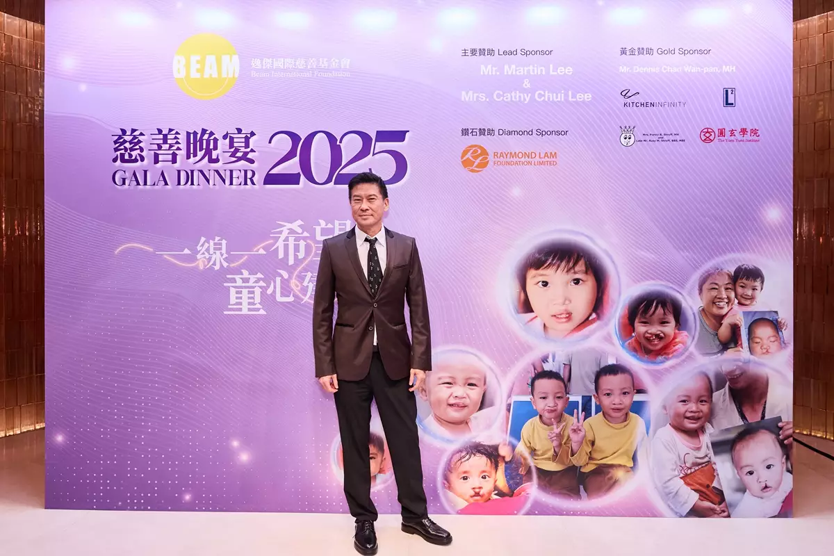 張佳添呼籲大家向唇顎裂小朋友伸出援手。