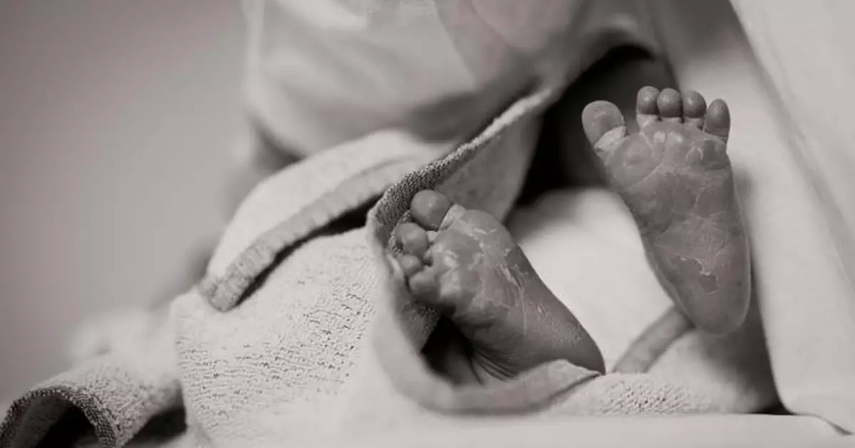 愛爾蘭挖掘796具嬰兒遺骸 母嬰之家黑暗歷史曝光