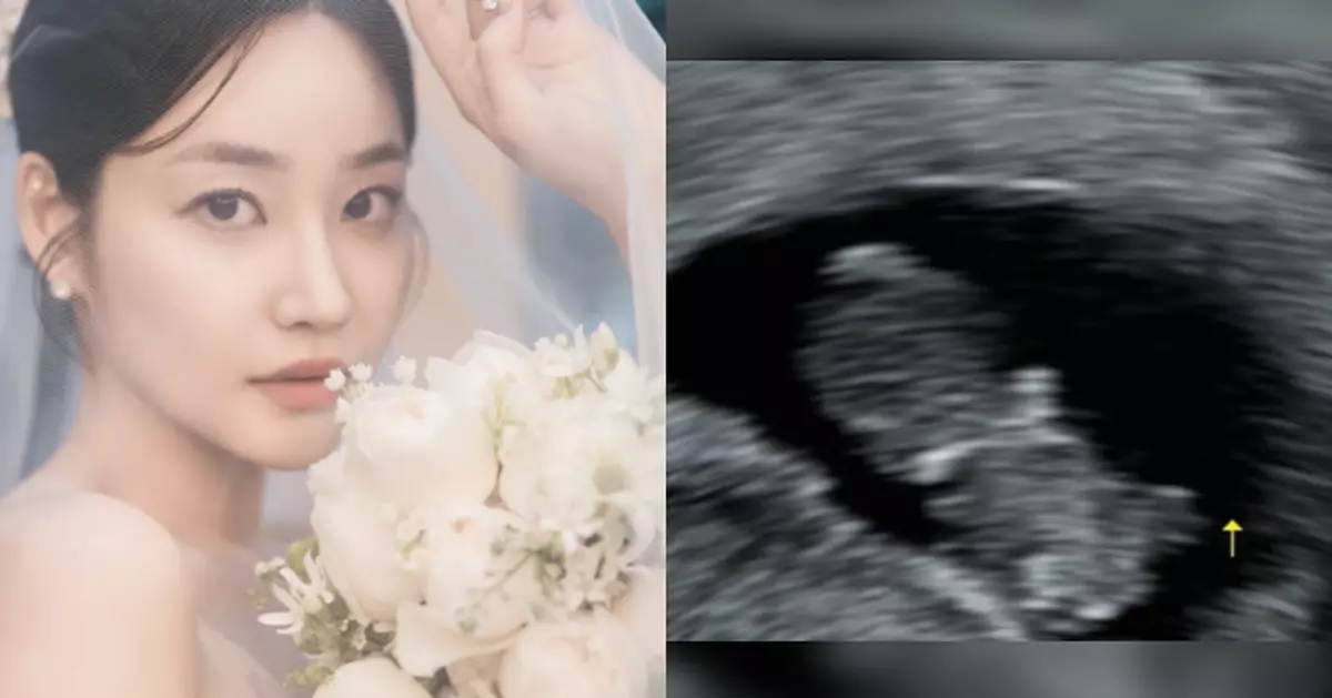 前AOA酉奈結婚一年半再報喜 晒超聲波照宣布懷孕