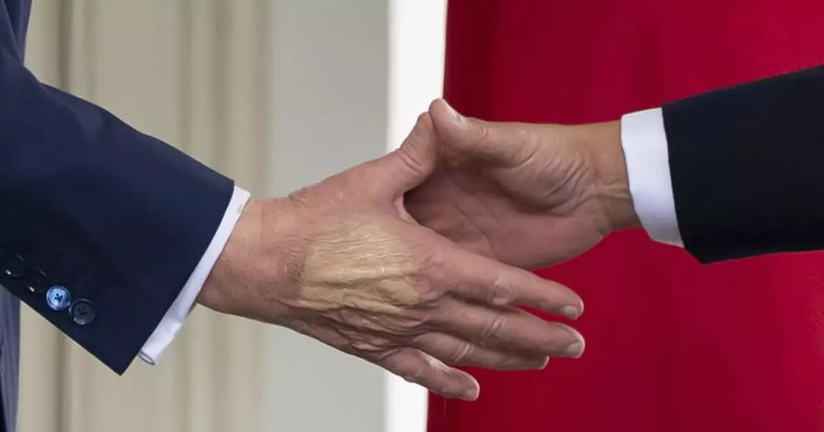 白宮稱特朗普患慢性靜脈功能不全 但強調其健康狀況仍然很好