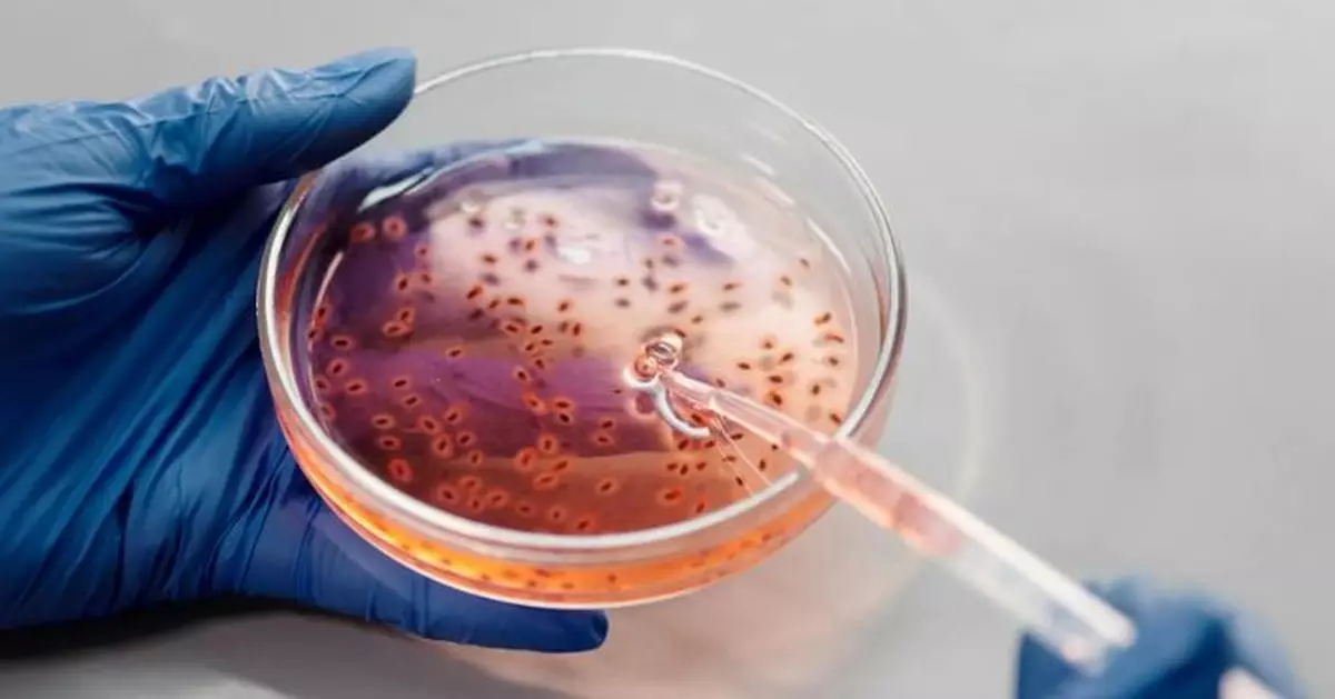 超級細菌危機爆發！研究揭2050年恐奪千萬命 全球GDP蒸發1.7萬億美元