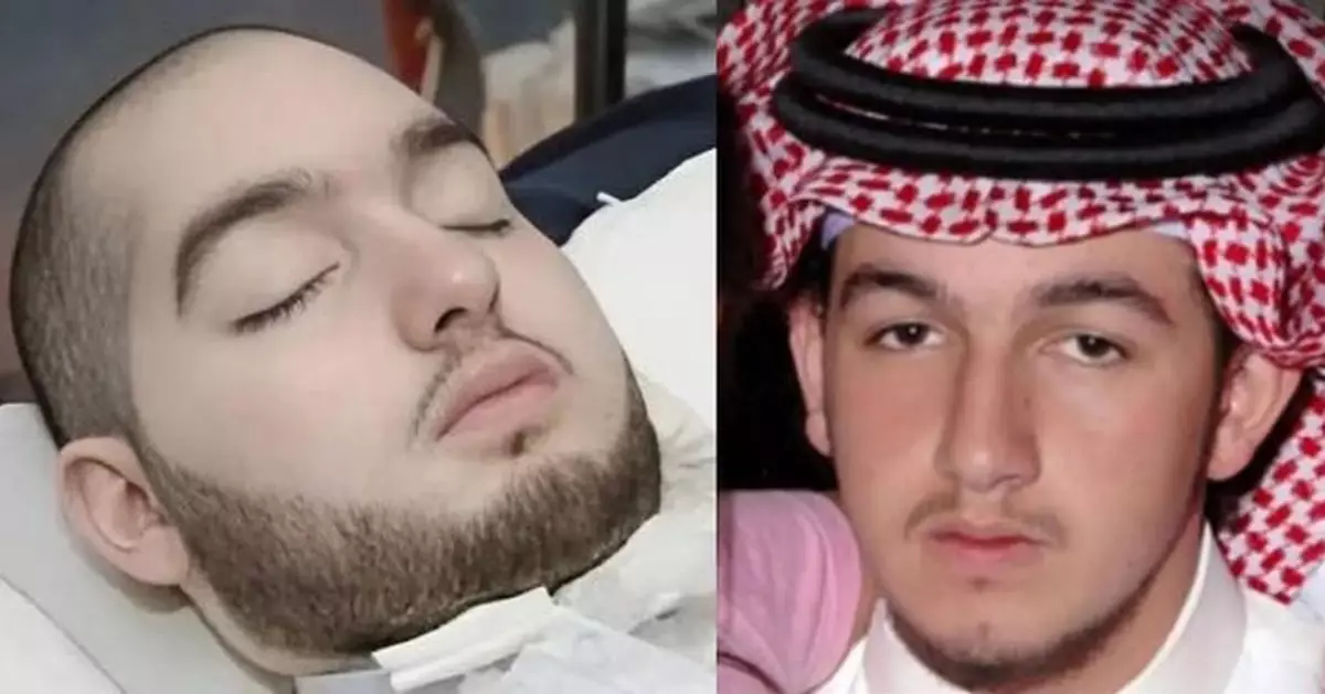 沙特「睡王子」離世終年36歲  父親曾曬「手指微動」影片盼奇蹟