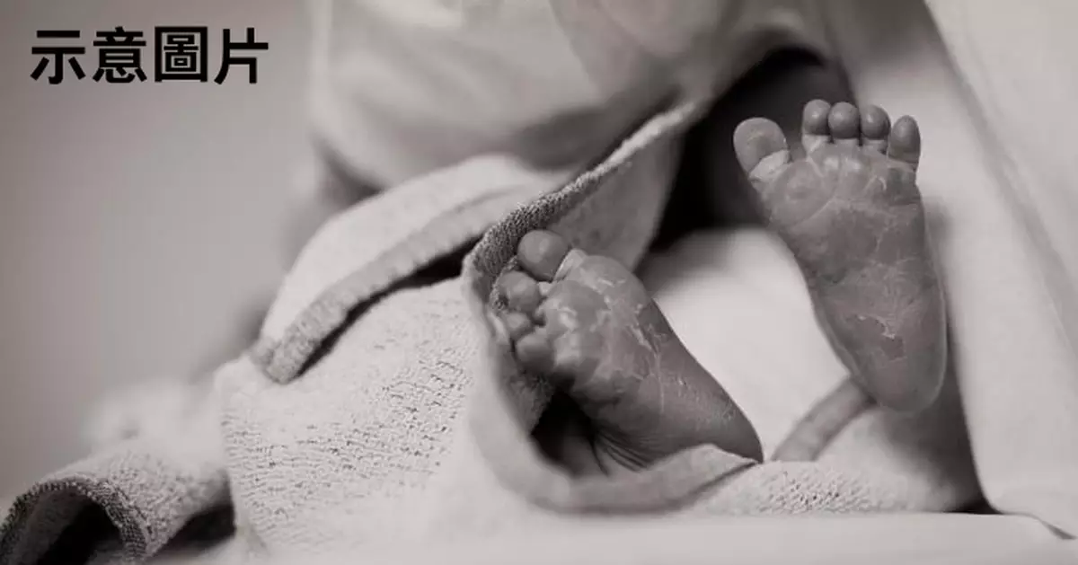 印尼4.2KG嬰孩出生頭部遭扯斷家屬怒提告 醫院辯稱：已胎死腹中