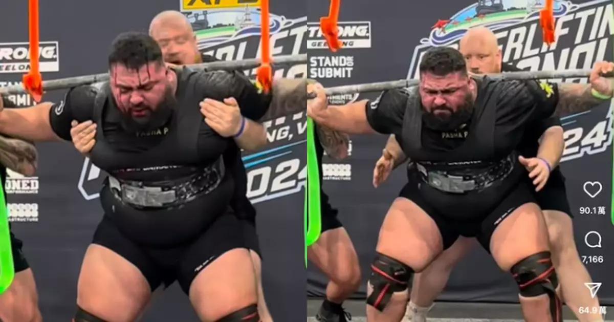 澳舉重選手挑戰扛410KG槓鈴深蹲 疑用力過度頭頂眼部突爆血染紅全臉