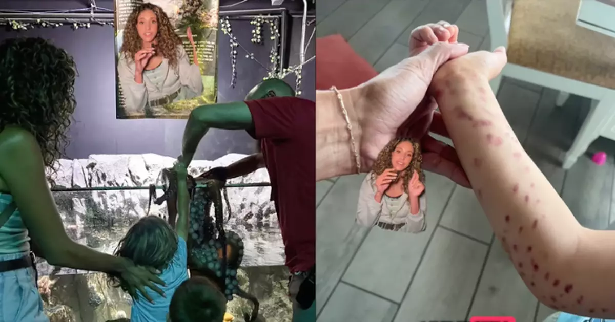 水族館與大章魚互動遇襲 美國6歲男童遭觸手緊纏手臂佈滿瘀傷