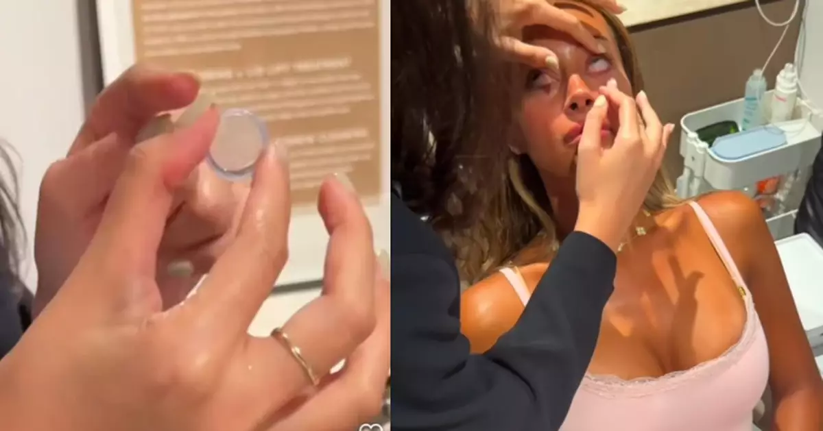 美國女模自爆雙眼植入「羊膜」治乾眼症 專家警告恐致感染失明勿盲目跟風