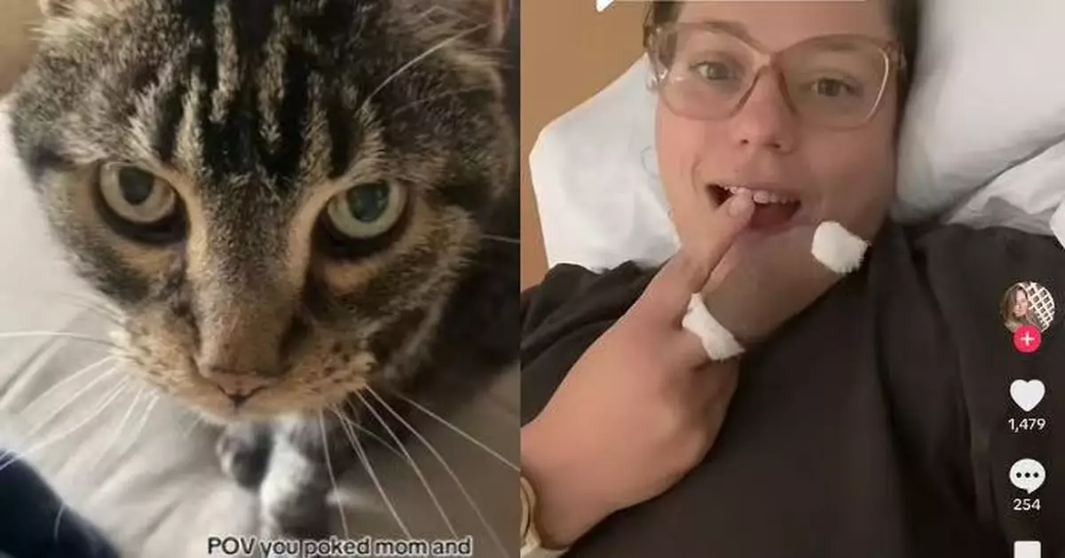 遭寵物貓爪刺傷指甲縫 美國女嚴重細菌感染需「拔除指甲」治療