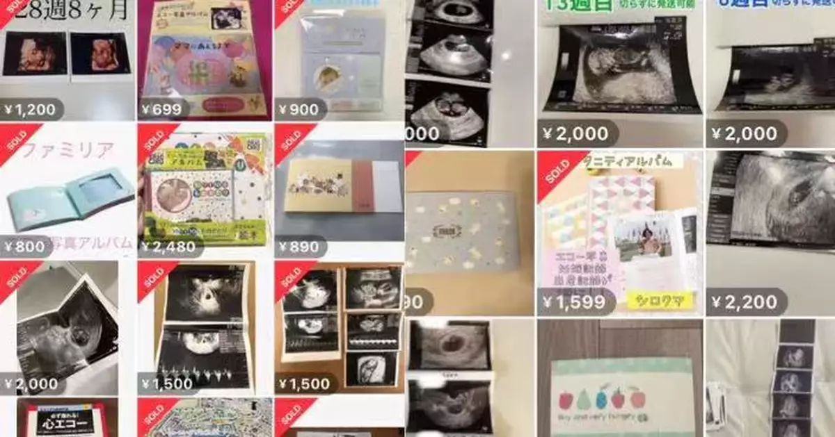 疑被用於假懷孕詐騙！日二手平台9月起禁售「胎兒超聲波照」