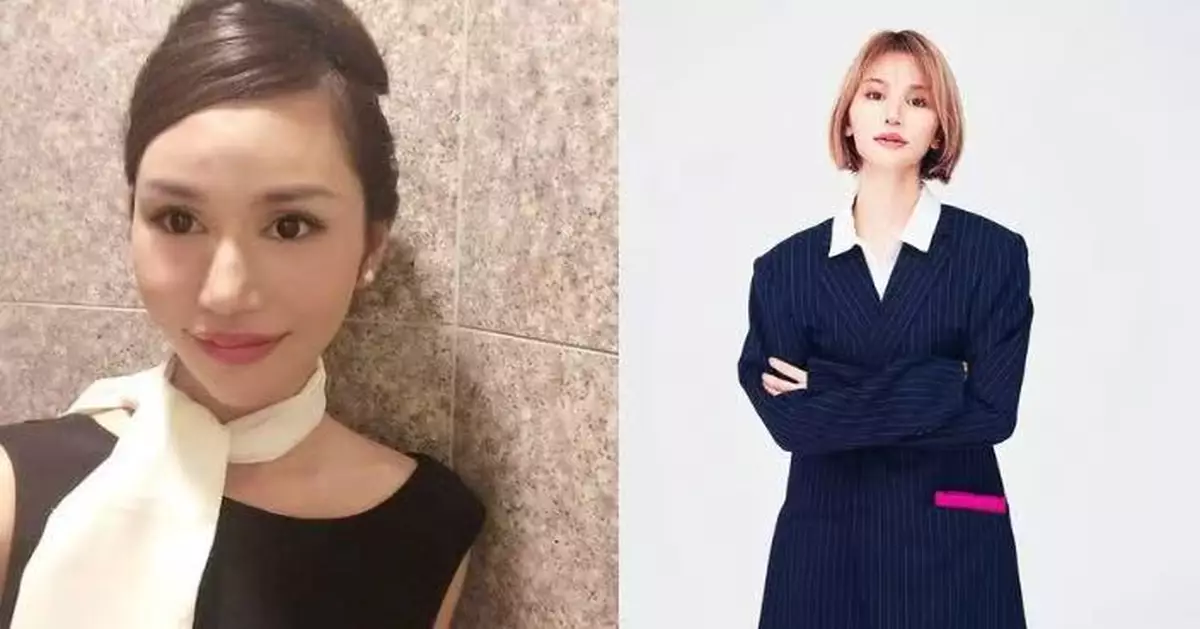 14歲開始做雙眼皮 日女星突自爆整形成癮已動刀28次