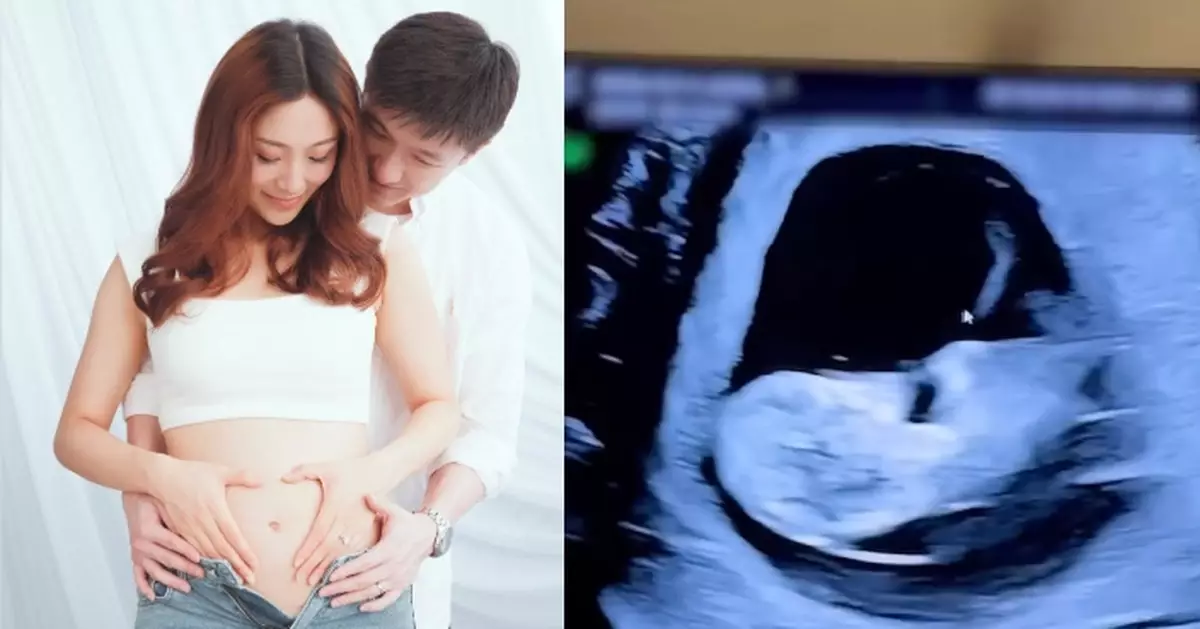 前東張女神IG報喜宣布懷孕好消息 黃愷怡：我們正在經歷一個奇跡