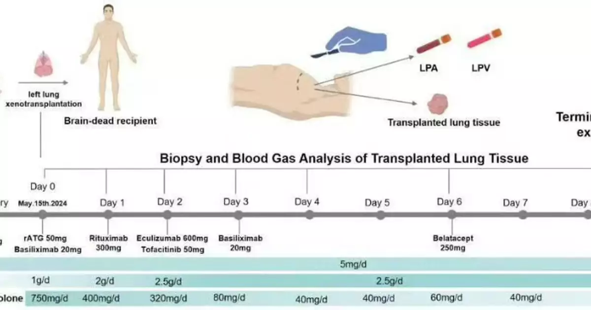 世界首例！廣州團隊成功將基因編輯豬肺移至人體 盼解決供體短缺問題