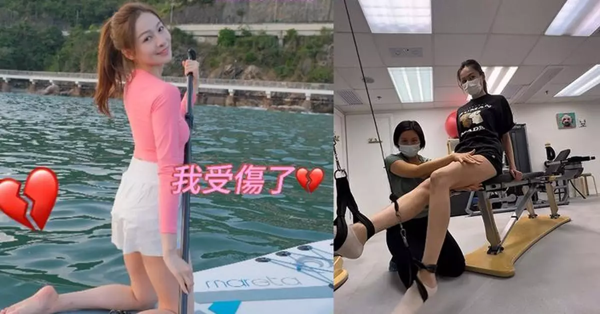 林鈺洧運動拉傷大髀筋致內出血 急做物理治療盼早日復工