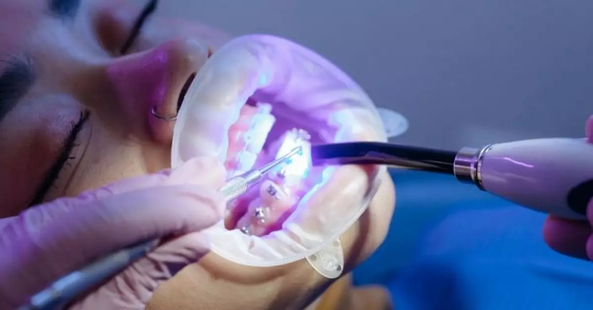 遼寧女戴牙套五年爛八顆牙 牙醫指未正確潔牙惹禍