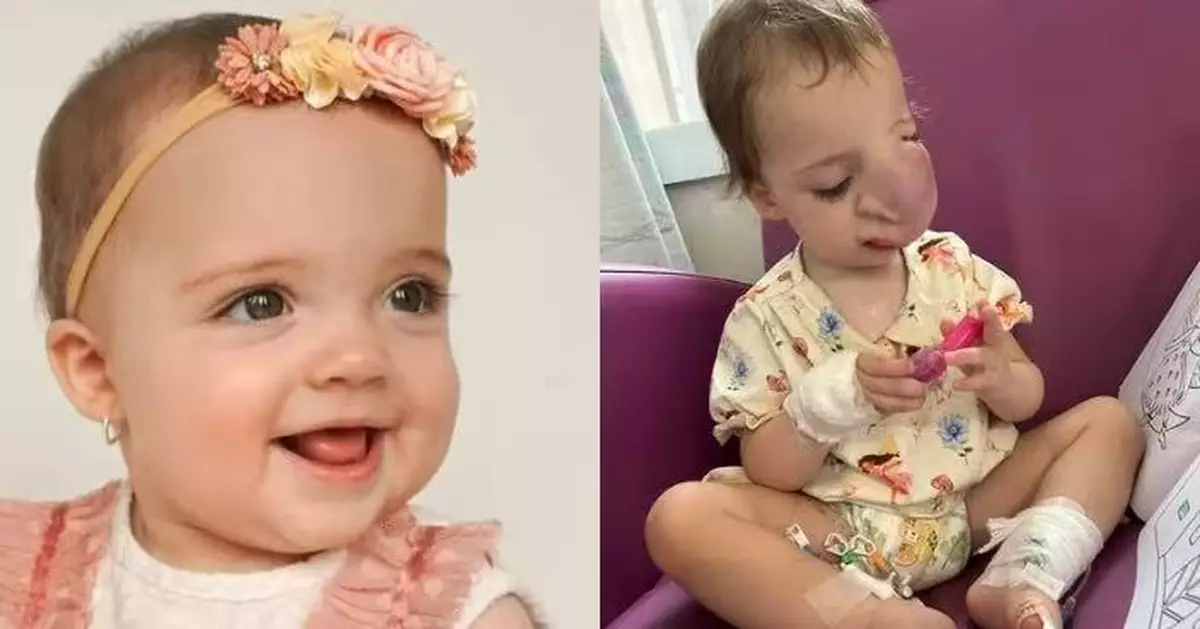 罹癌臉長腫塊被當虐待傷痕 英1歲女童半年兩度被誤診錯失治療期身亡