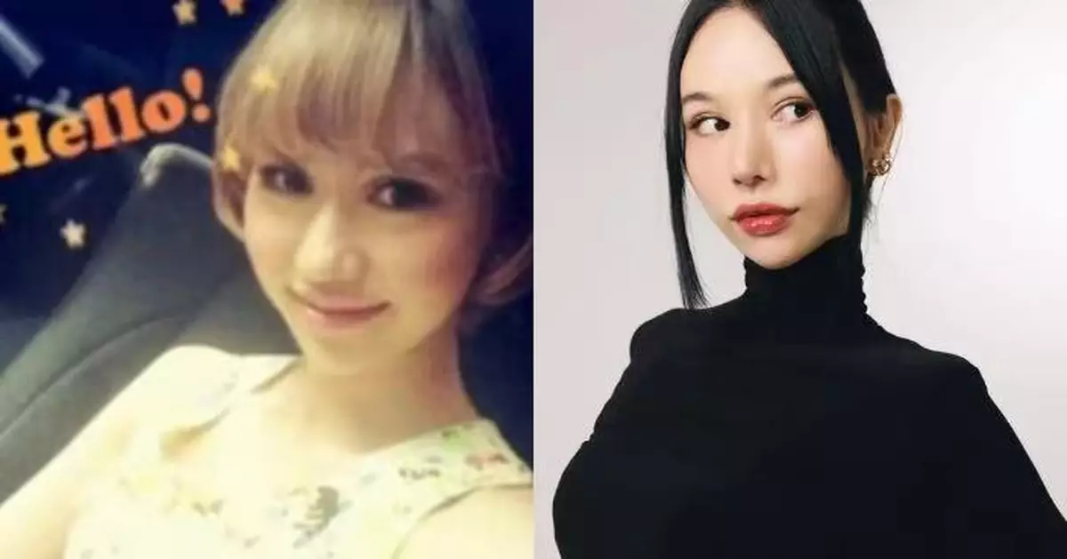 日混血女星自曝14歲割雙眼皮 至今已超28次坦言整容成癮「停不下來」