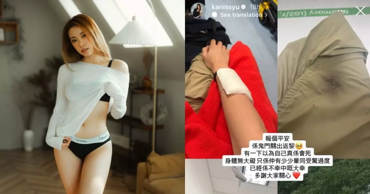 「東張女神」俞可程發生車禍險死 事後仍心有餘悸：有一下以為自己真係會死