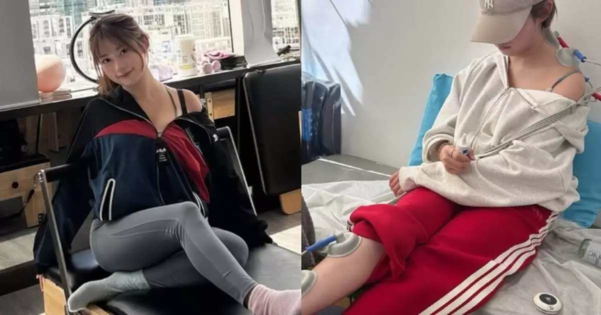 波波黃婧靈自嘲係「玻璃娃娃」 雙腳滿佈瘀傷兼要做物理治療