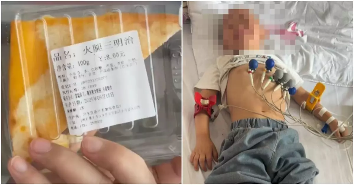 貴州遵義多人疑食三文治後中毒　肝腎功能異常入院包括多名兒童