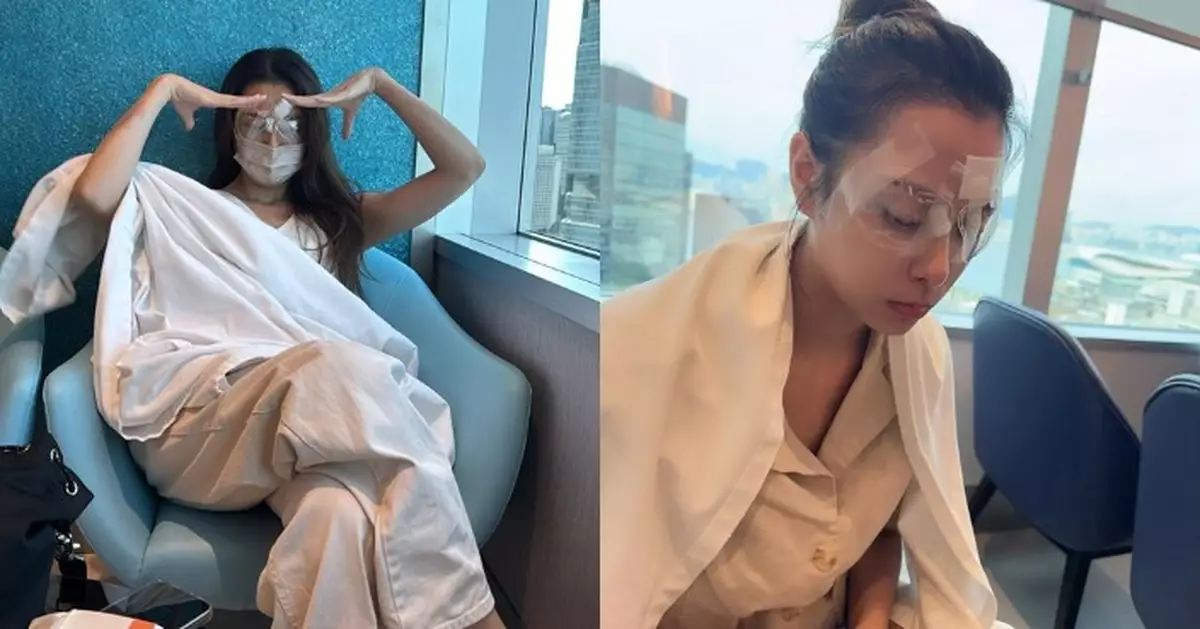 「東張女神」俞可程激光矯視驚現罕見意外 眼角膜瓣移位急重鋪