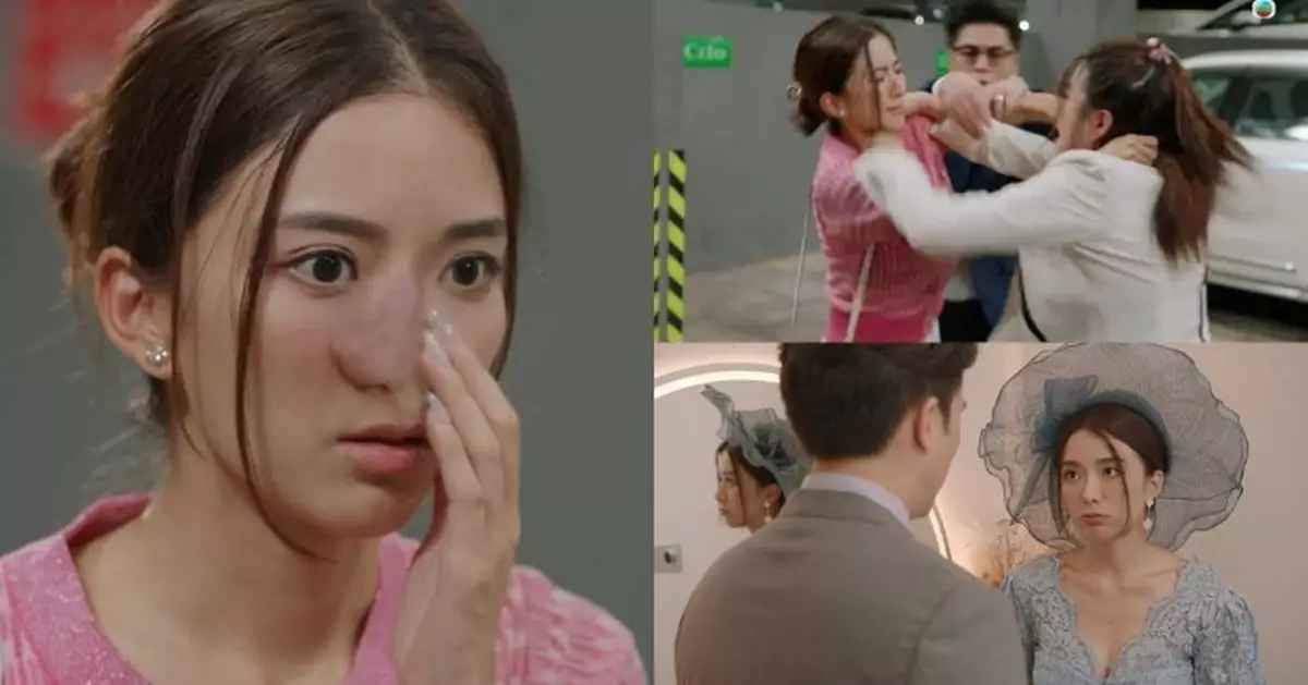 金式森林｜被打歪鼻引爆熱話 陳星妤親揭撞樣「方媛頭」真相