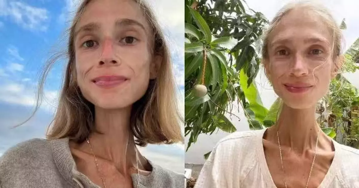 生前體重僅22KG！波蘭女信奉「果食主義」終因營養不良客死峇里島酒店